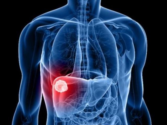 Xét nghiệm mới Liver IndirectImmunology-Fluorescence Test